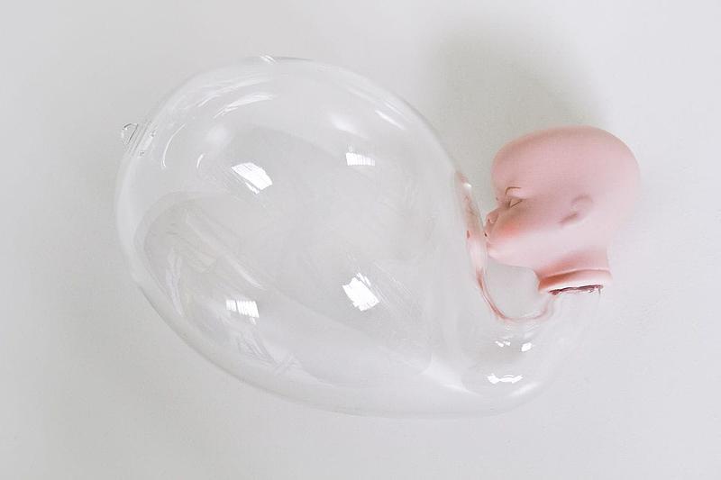 Ellen Urselmann - No title '10